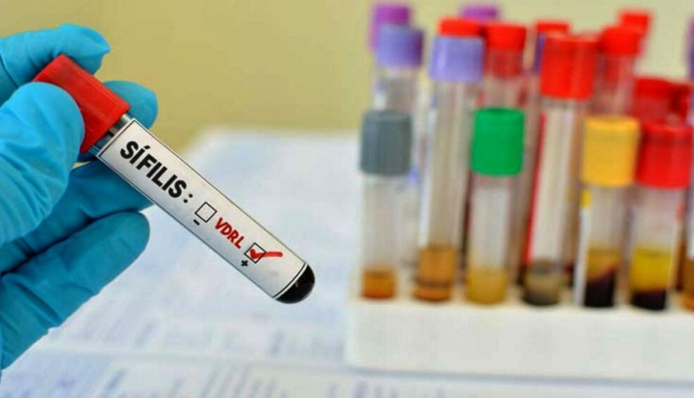 Sífilis en alza en Tierra del Fuego: los casos se duplicaron en un mes