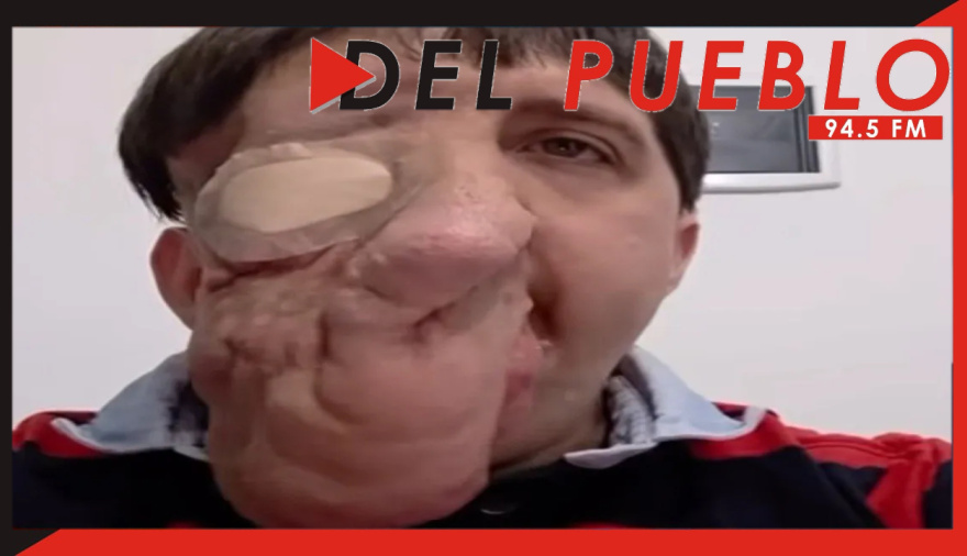 Con la ayuda de la gente, Rubén Monsalve se prepara para una operación de alta complejidad