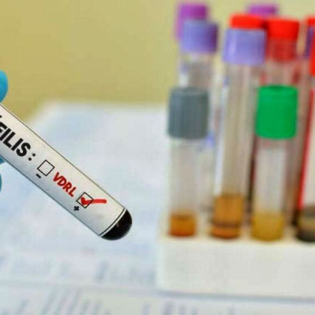 Sífilis en alza en Tierra del Fuego: los casos se duplicaron en un mes